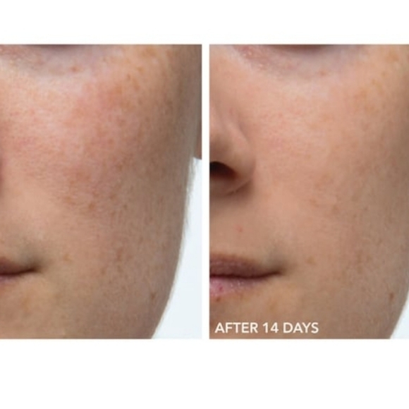 πDr David Gross - Alpha Beta π - Picture 2 of 8